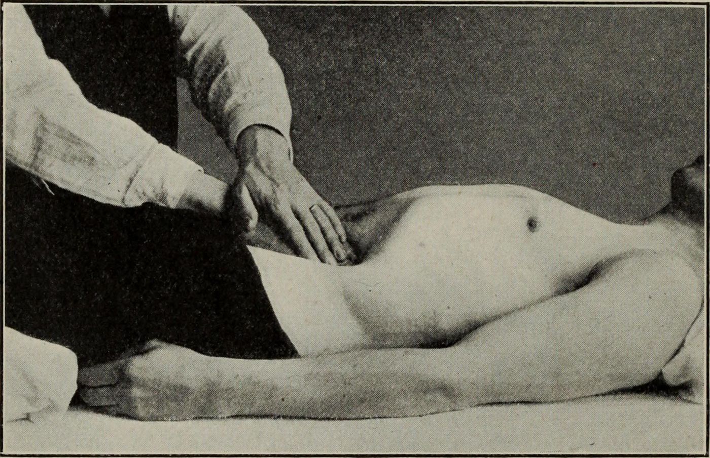 A photograph from a 1917 massage manual: a therapist's hand working a client's lower back and hip while the client lies face down.